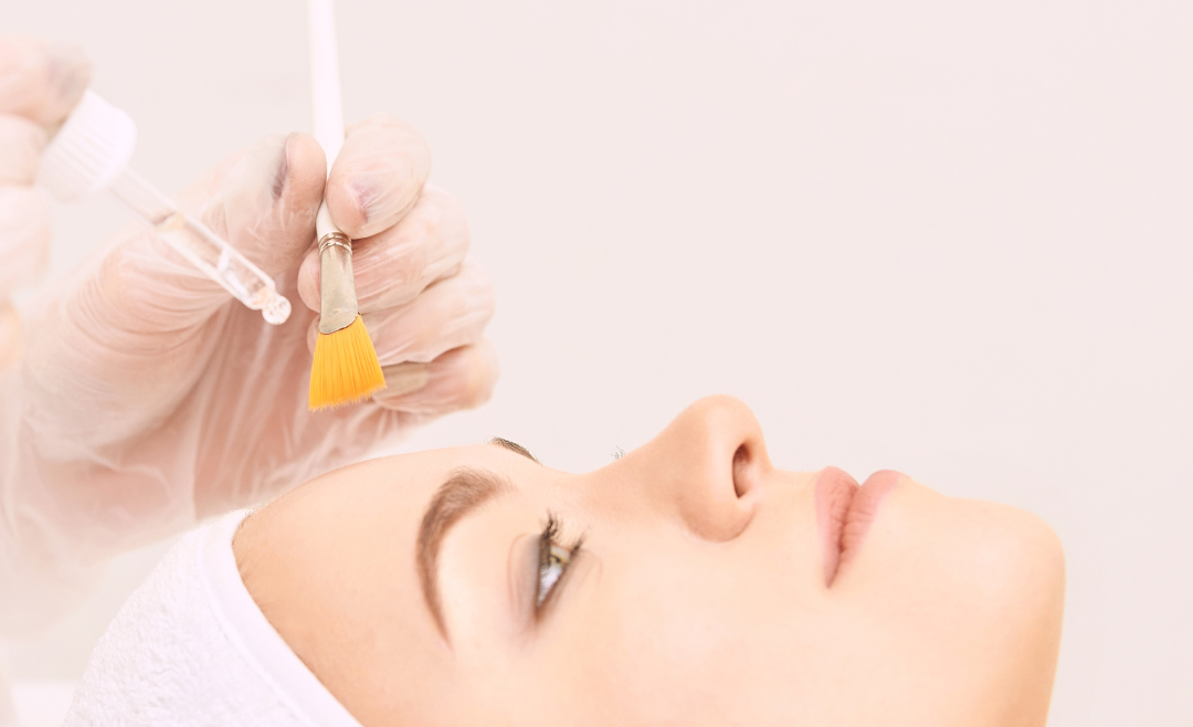 The Magic of Chemical Peel Treatments: Your Guide to Radiant Skin￼