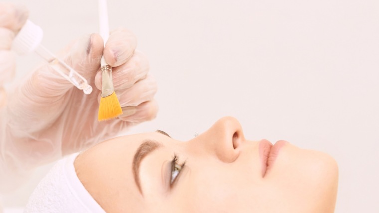 The Magic of Chemical Peel Treatments: Your Guide to Radiant Skin￼