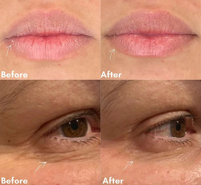 Before After