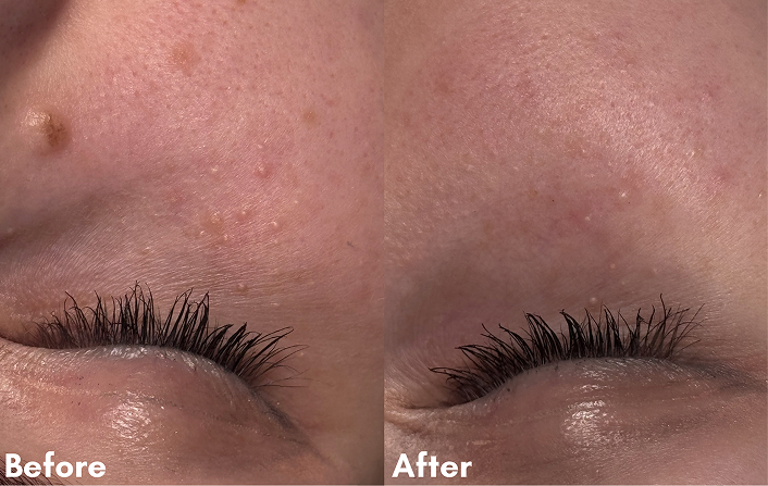Before After