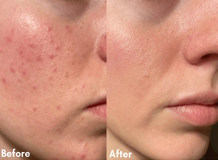 Before After