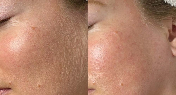 Before After