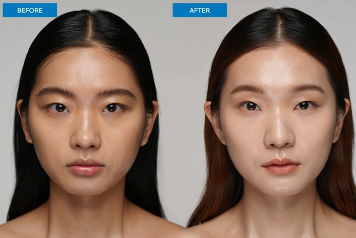 Before After