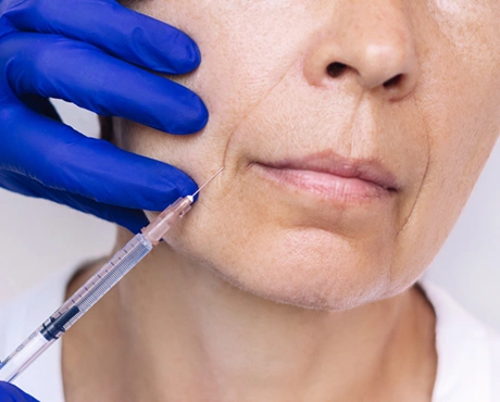 Dermal Fillers