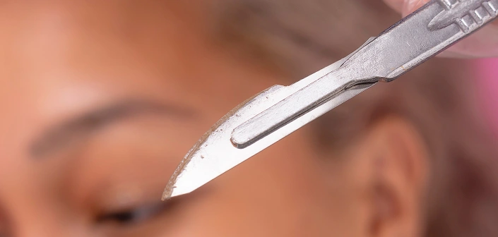 Dermaplaning