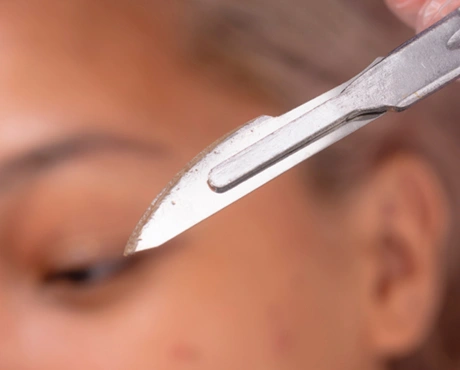 Dermaplaning
