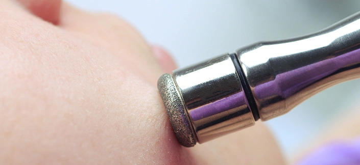 Diamond Microdermabrasion