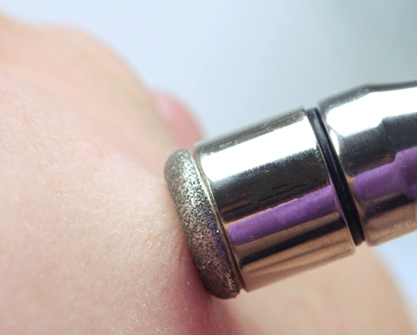 Diamond Microdermabrasion