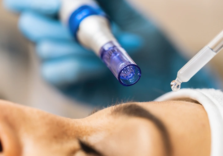 Exosome Skin Regeneration