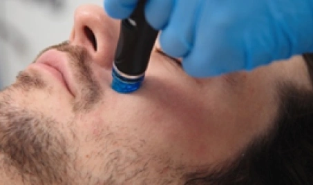 HydraFacial