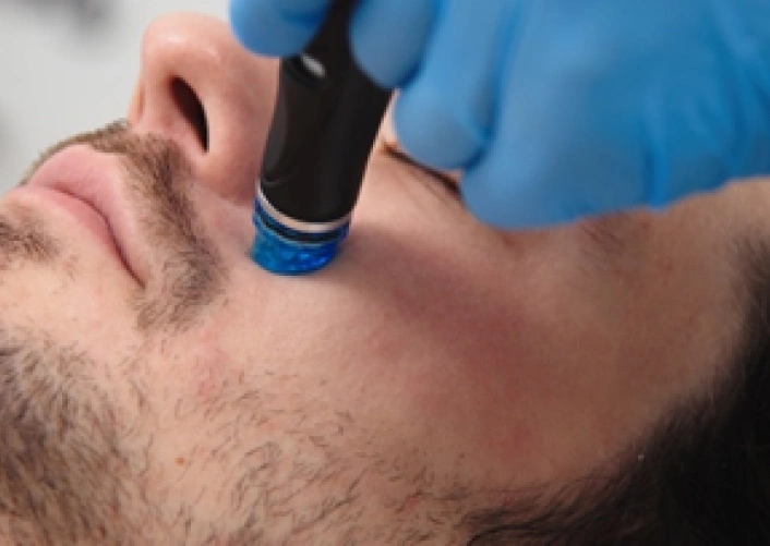 Men’s Treatments