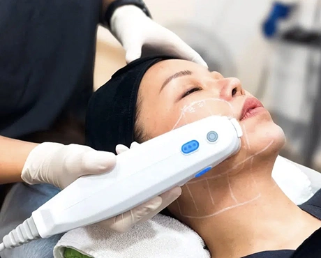 Ultherapy PRIME