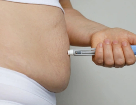 Weight Loss Clinic