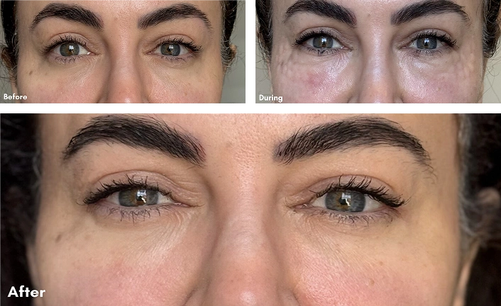 Before After