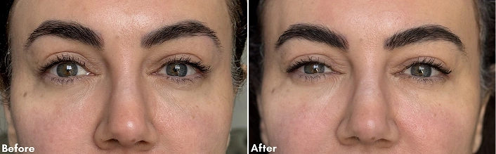 Before After