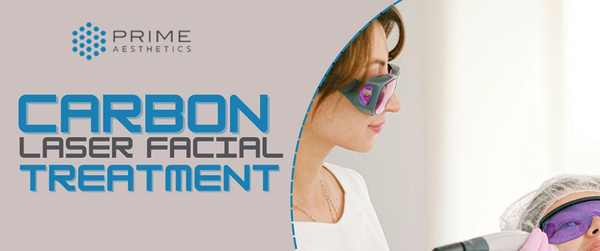 Carbon Laser Treatment