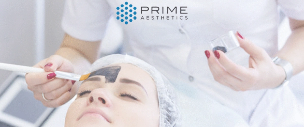 Carbon Laser Treatment