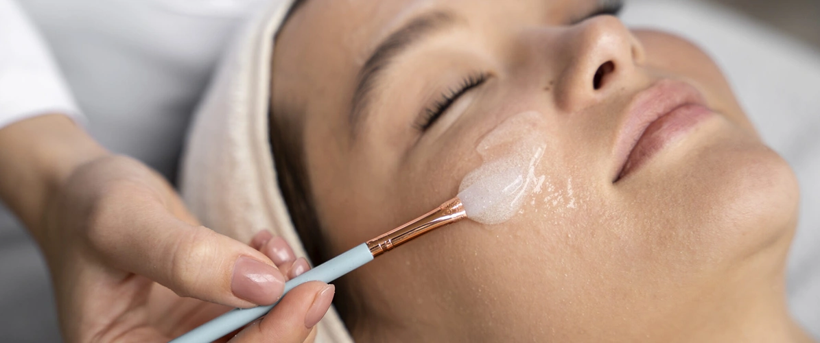 Chemical Peel