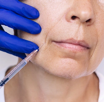 Dermal Fillers