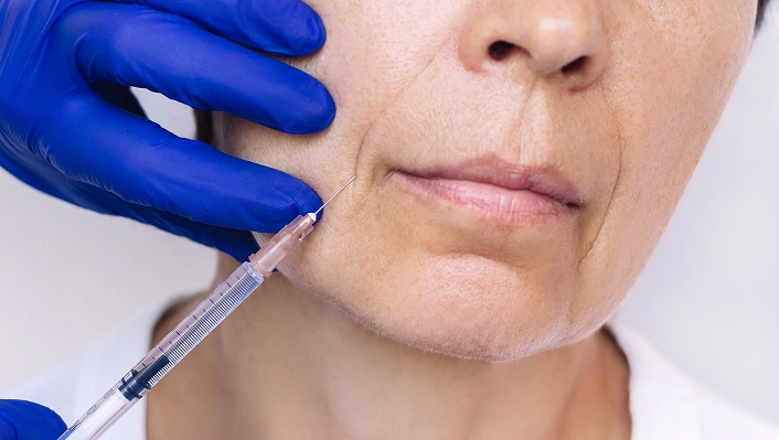 Dermal Fillers