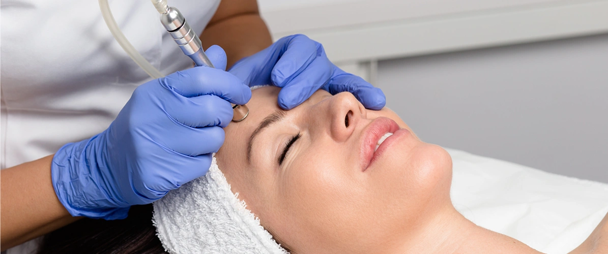 Diamond Microdermabrasion