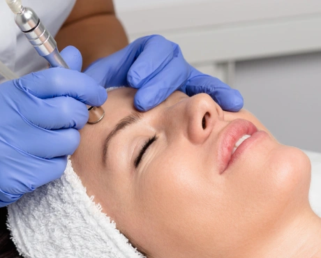 Diamond Microdermabrasion