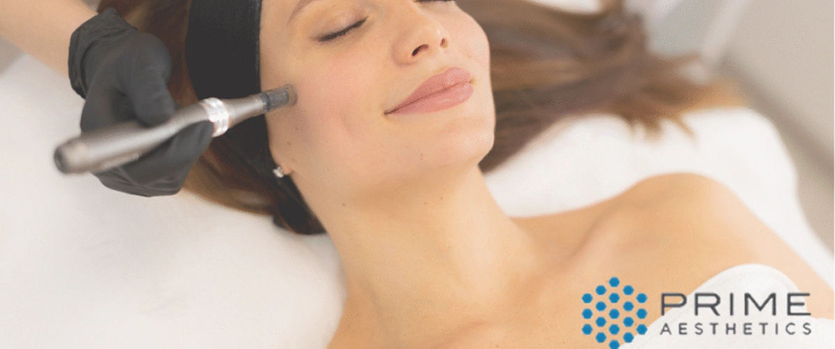 Expert Microneedling Treatment