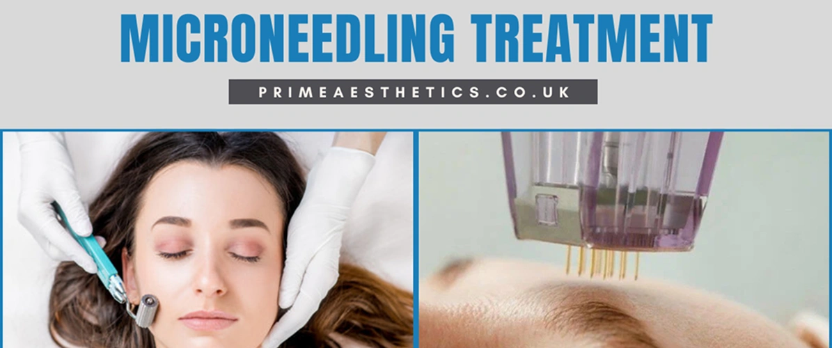 Expert Microneedling Treatment