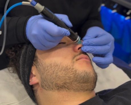 HydraFacial