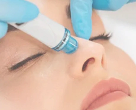 HydraFacial Treatment