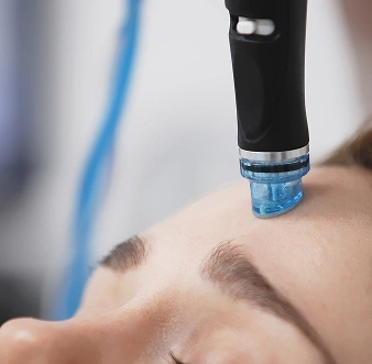 Hydrafacials