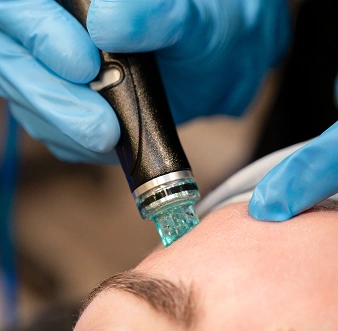 Hydrafacials 4