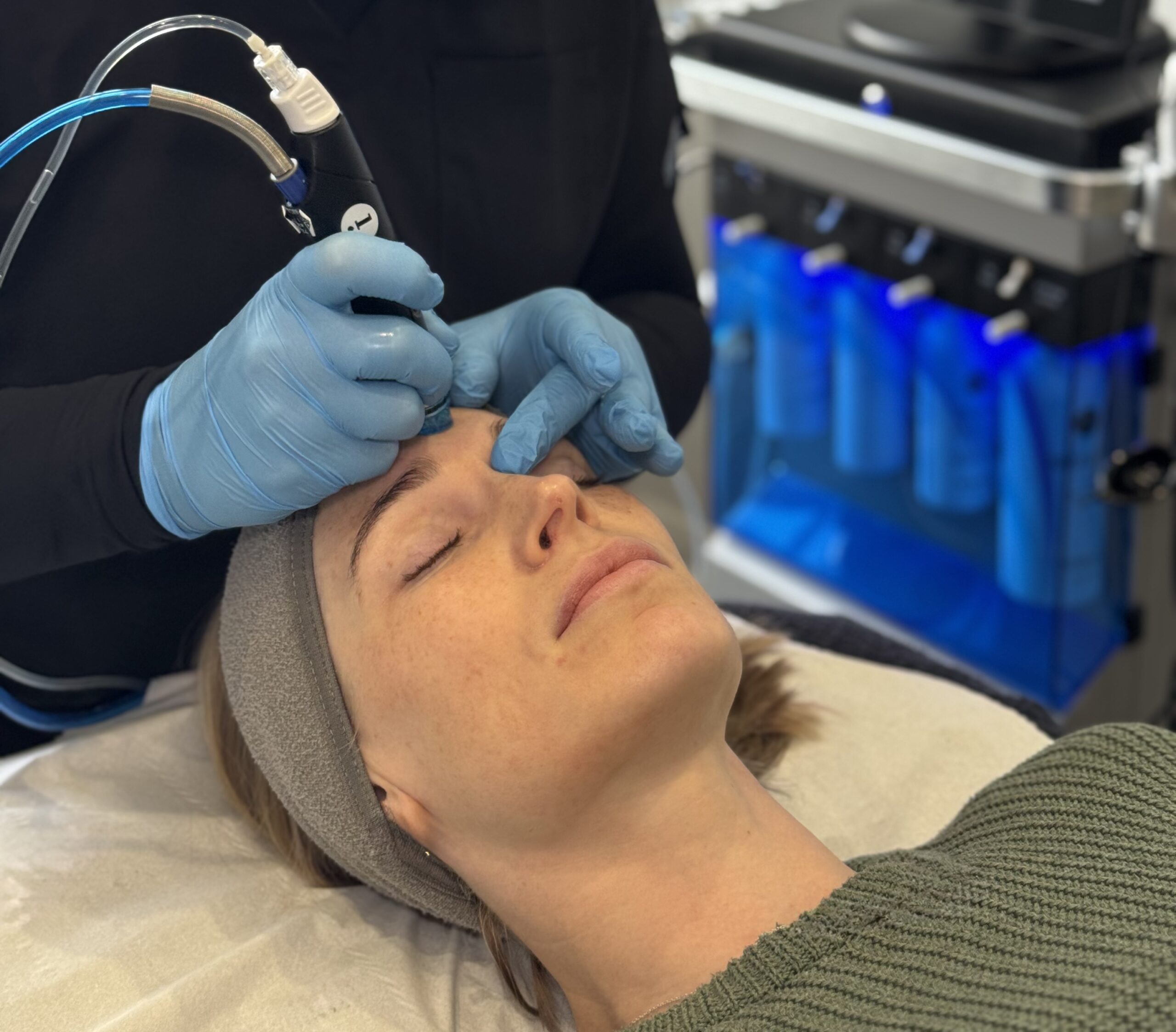 Hydrafacials