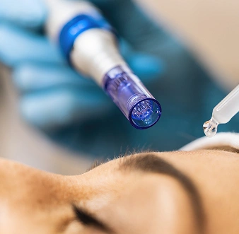 Mesotherapy