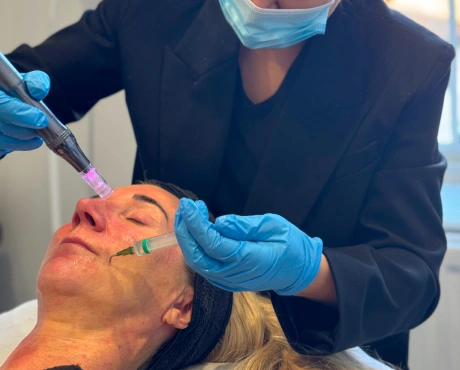 Mesotherapy