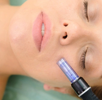 Microneedling