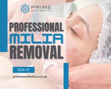 Milia Removal
