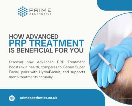 PRP Treatment