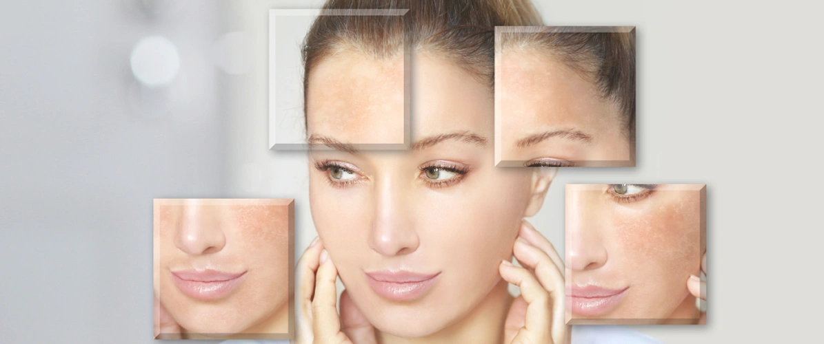 Personalized Skin Consultation