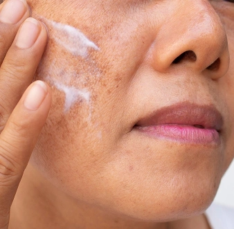 Personalized Skincare