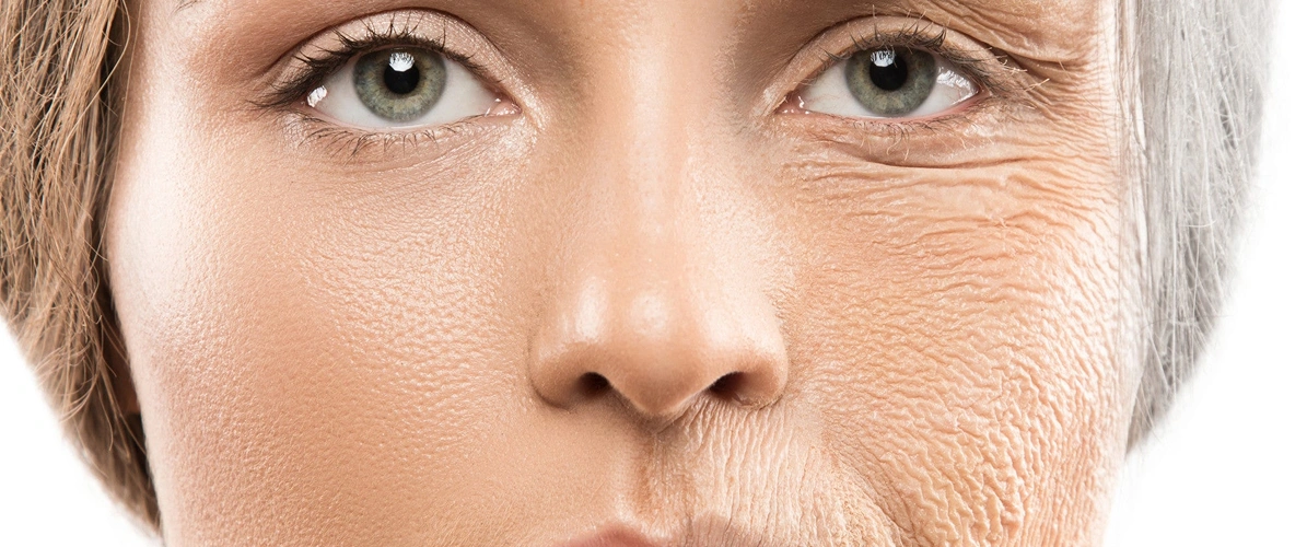 Photofabulous Treatment