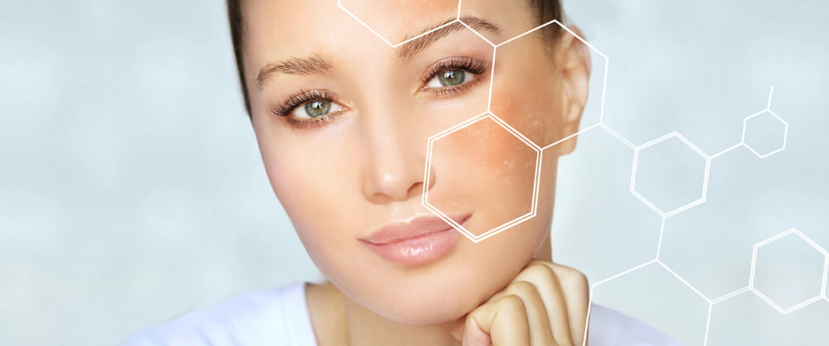Skin Boosters
