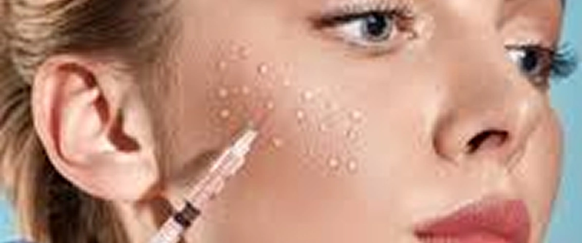 Skin Boosters