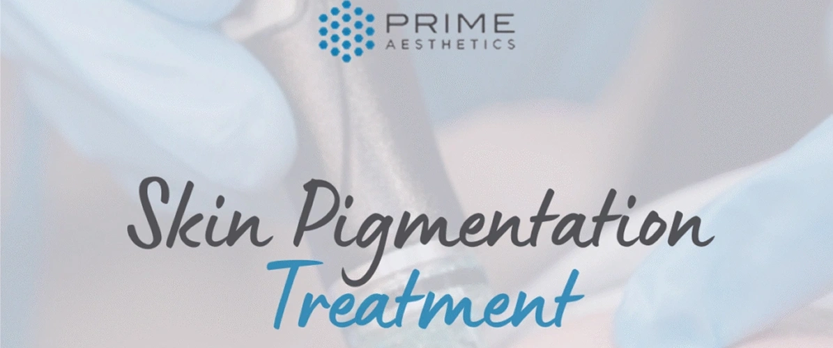 Skin Pigmentation Treatment