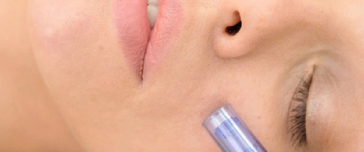 Uneven Skin Texture