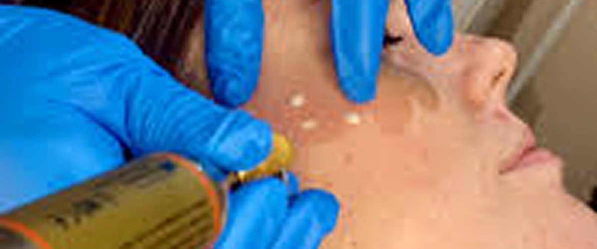 Yellowish Bumps