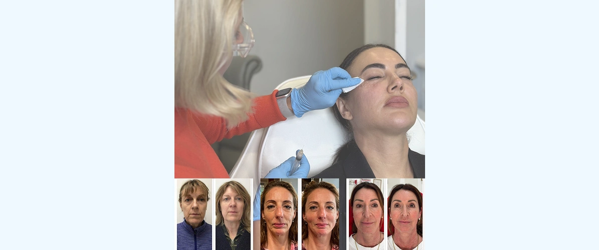 Aesthetics Sevenoaks