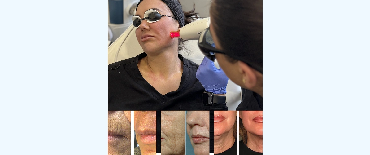 Aesthetics Sevenoaks