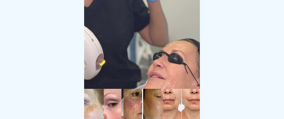 Aesthetics Sevenoaks