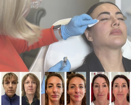 Aesthetics Sevenoaks